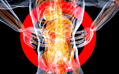 Navigating Compensation for Spinal Cord Injuries in Wisconsin