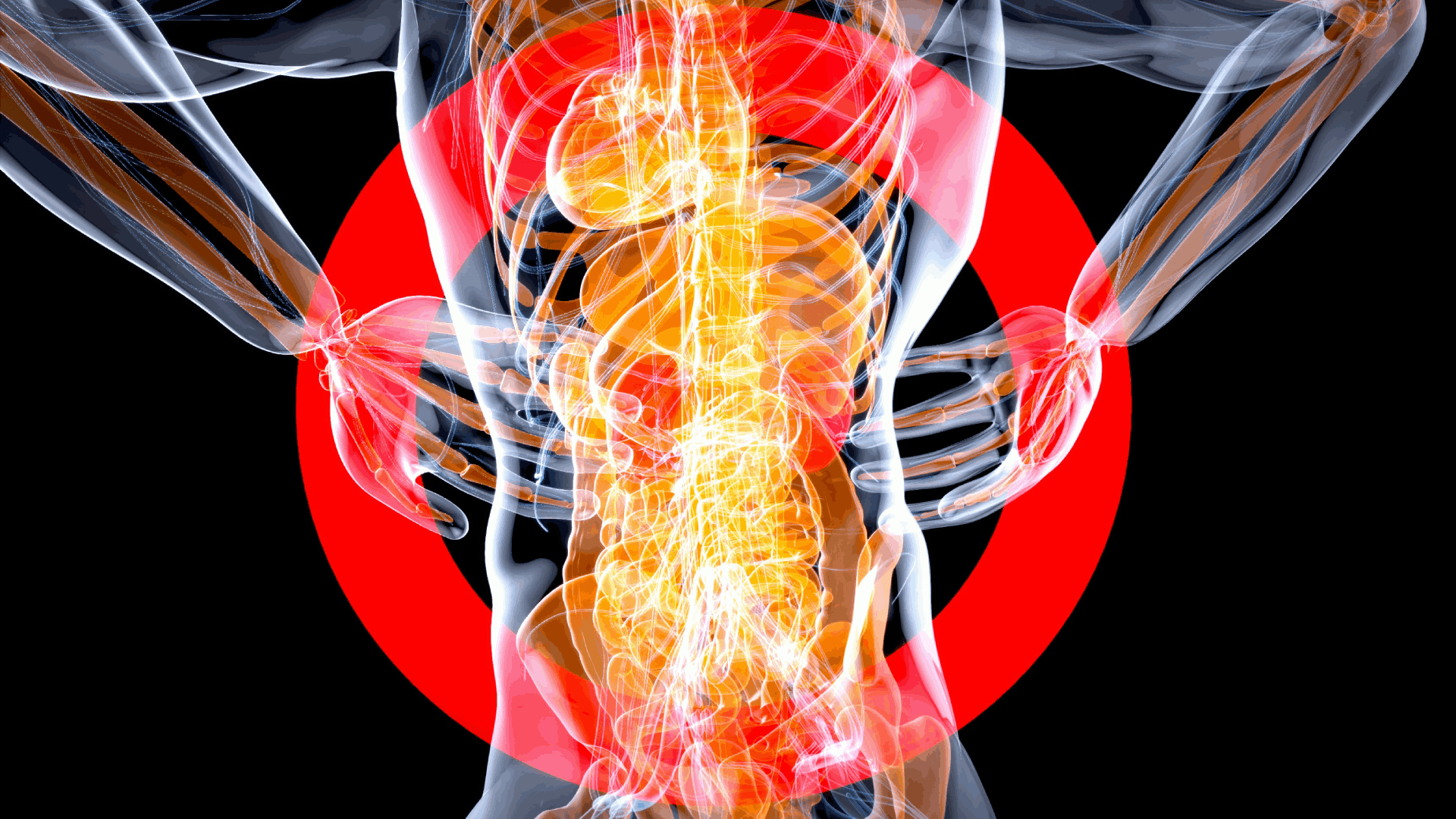 spinal cord injury
