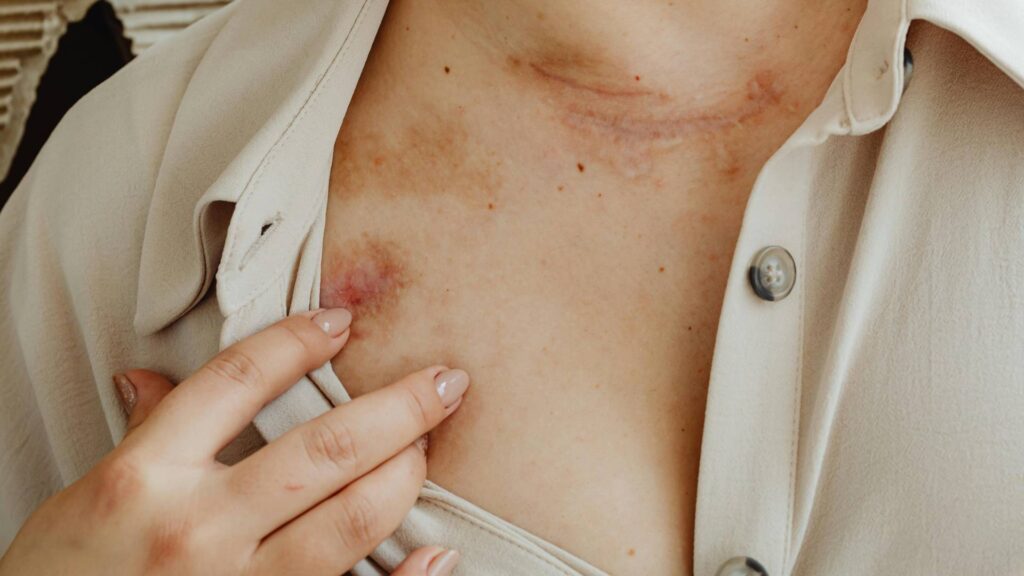 The Role Of Evidence In Proving Your Personal Injury Case 1